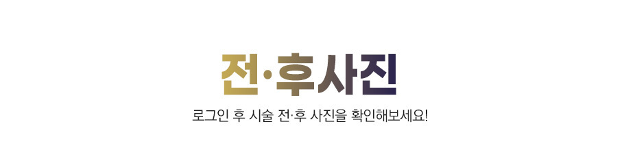 전후사진