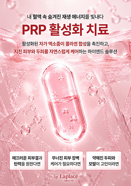 PRP 활성화 치료